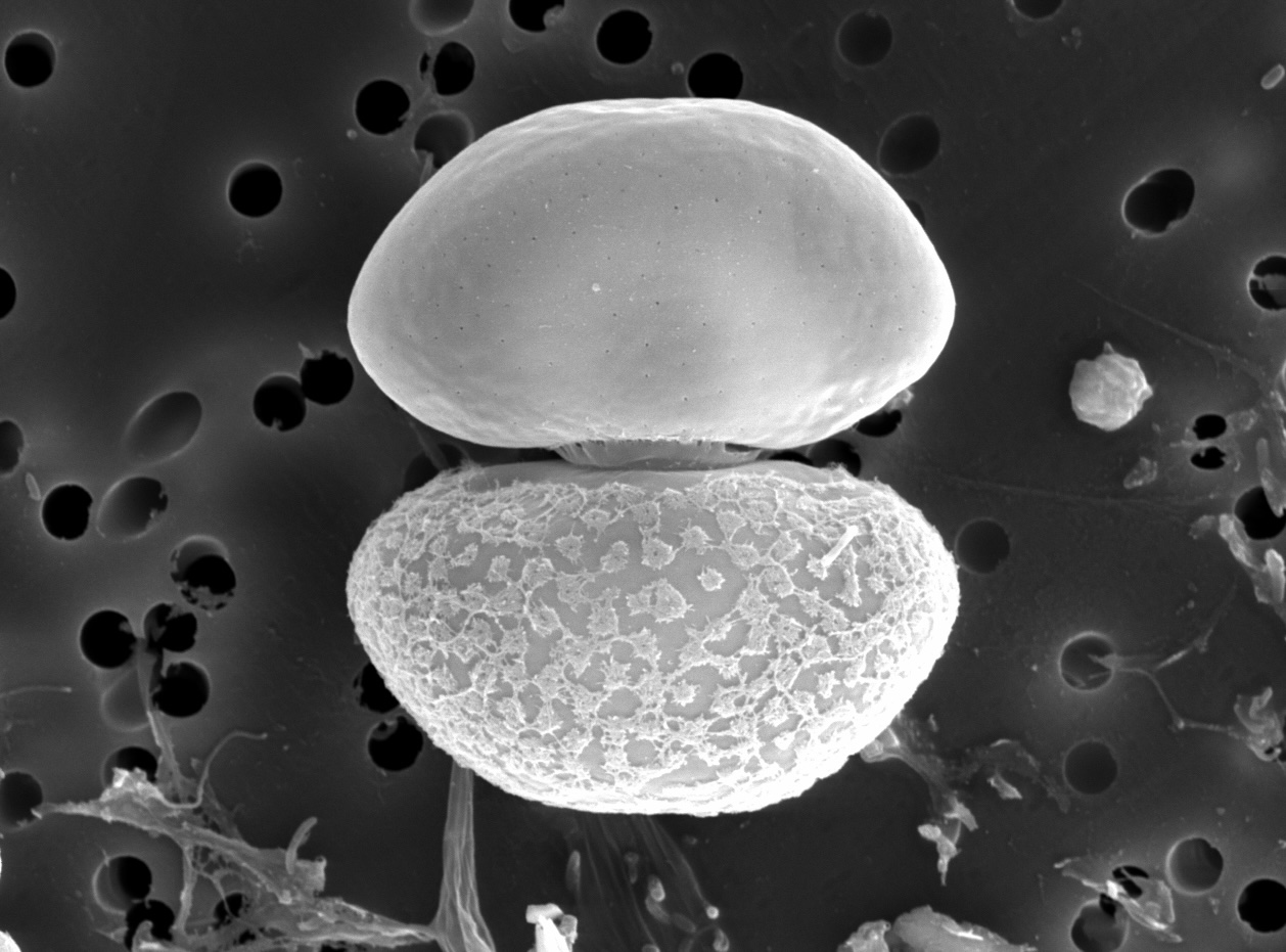 Cosmarium pseudoprotuberans